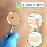 Wart Spot Nevus Remover Cream Painless Mole Dark Spot Warts Remover Serum Freckle Face Wart Tag Treatment Removal Essential Oil - Image 3