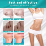 Wart Spot Nevus Remover Cream Painless Mole Dark Spot Warts Remover Serum Freckle Face Wart Tag Treatment Removal Essential Oil - Image 4